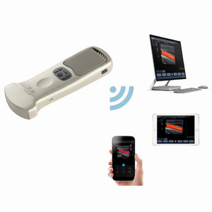 YSB363 Ysenmed color doppler wireless ultrasound probes portable high frequency best handheld portable wireless ultrasound