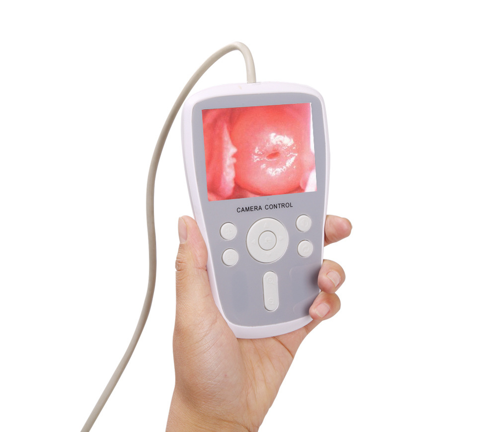 Portable Digital Colposcope Camera  With Video For Gynecology Video Colposcope Hd Video Colposcope Vaginal Camera for Vagina