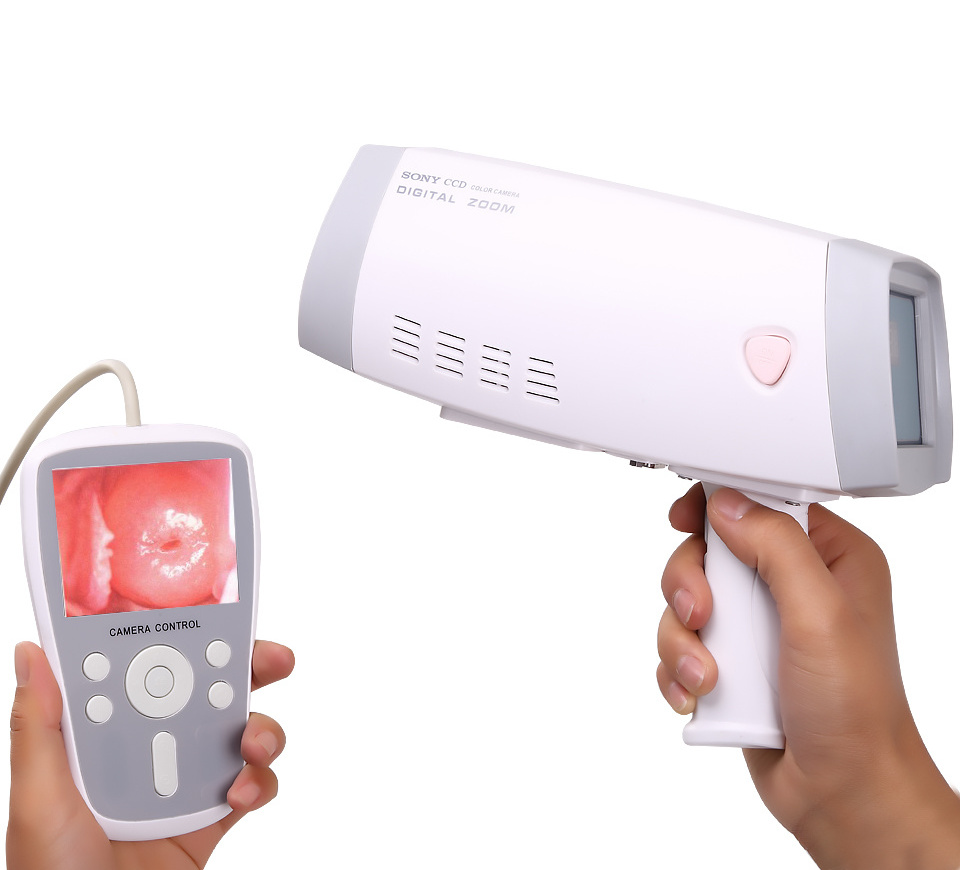 Portable Digital Colposcope Camera  With Video For Gynecology Video Colposcope Hd Video Colposcope Vaginal Camera for Vagina