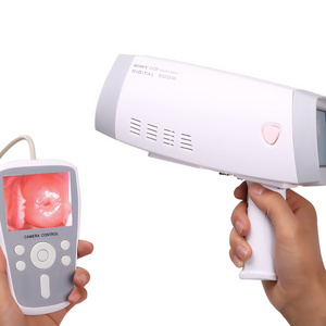 Portable Digital Colposcope Camera  With Video For Gynecology Video Colposcope Hd Video Colposcope Vaginal Camera for Vagina