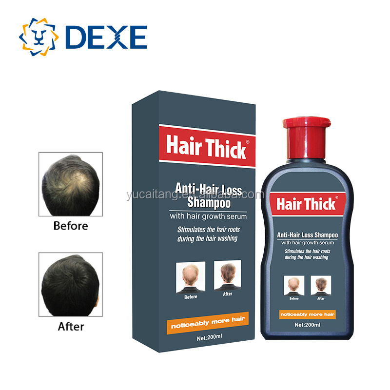 Private Label Manufacturers Hair Growth Restore Shampoo For Hair Loss Care Treatment shampoo 200ml Wholesale Product OEM ODM