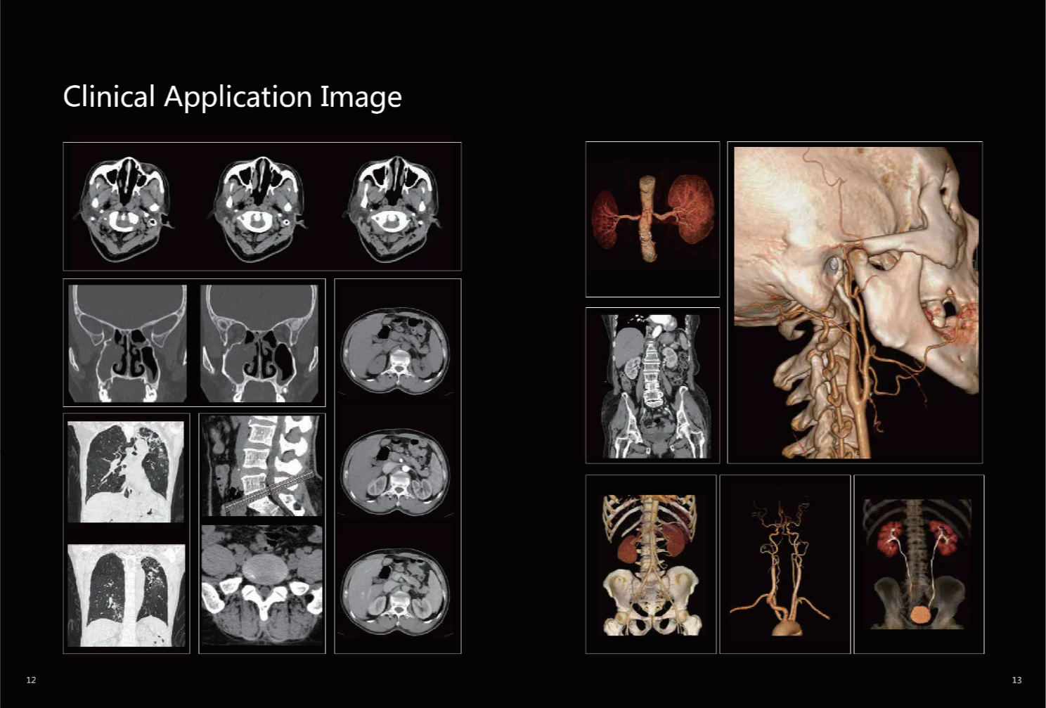 Hospital Radiology Computed Tomography Equipment Medical 128 Slice CT Scan Machine Price