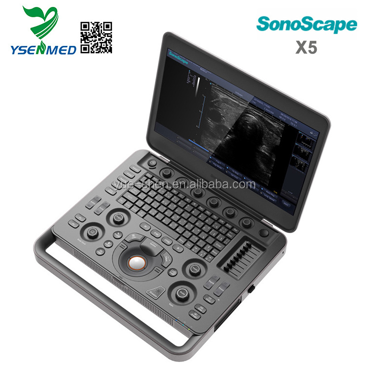 Factory price Sonoscape X5 portable 3D ultrasound system 4d color doppler ultrasound wholesale ysenmed sonoscape ultrasound X5