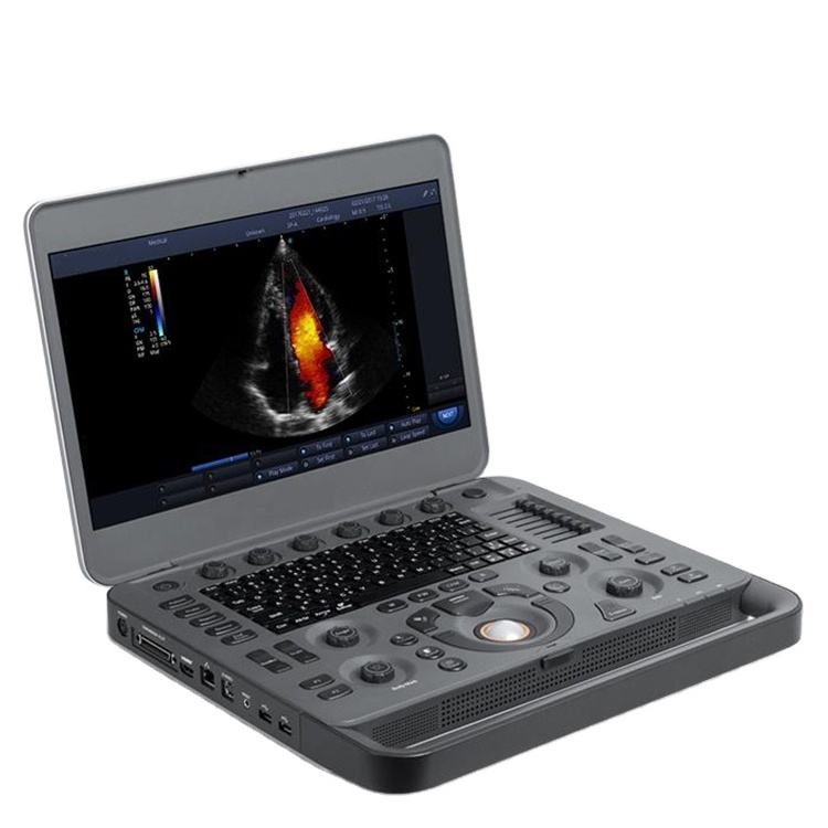 Factory price Sonoscape X5 portable 3D ultrasound system 4d color doppler ultrasound wholesale ysenmed sonoscape ultrasound X5