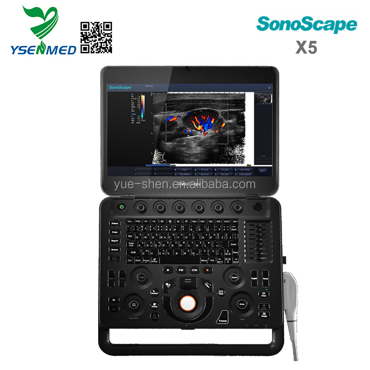 Factory price Sonoscape X5 portable 3D ultrasound system 4d color doppler ultrasound wholesale ysenmed sonoscape ultrasound X5