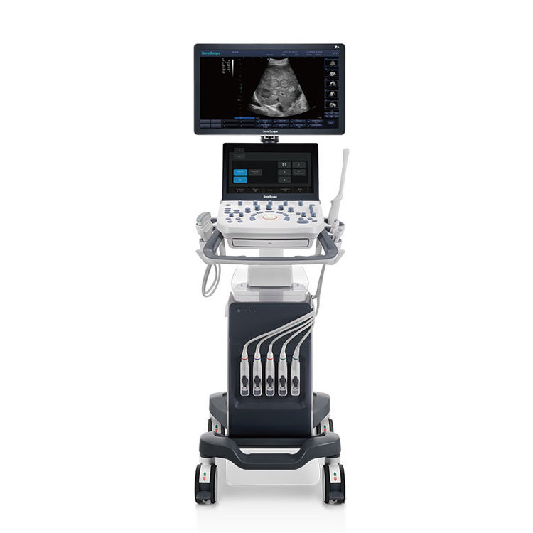 Sonoscape P9 ultrasound machine medical trolley color doppler 4D 3D human ultrasound 4d diagnostic human ultrasound 4d system