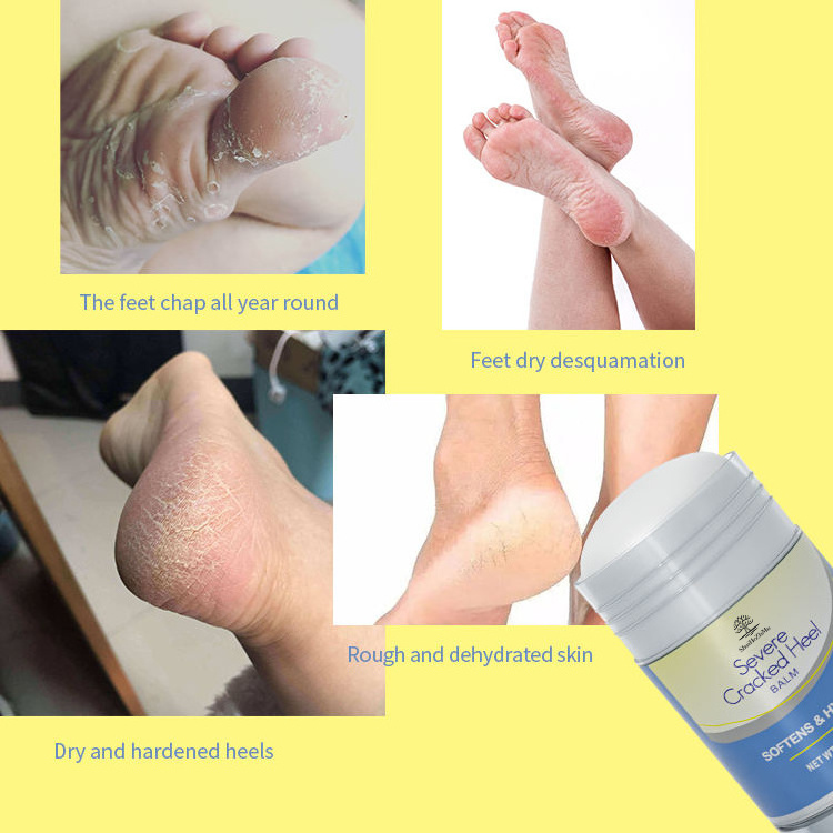 Foot Skin Care Lavender Foot Cream Foot Repair Balm Stick Skin Moisturizer For Dry Cracked Feet Hands Heels Elbows Knees