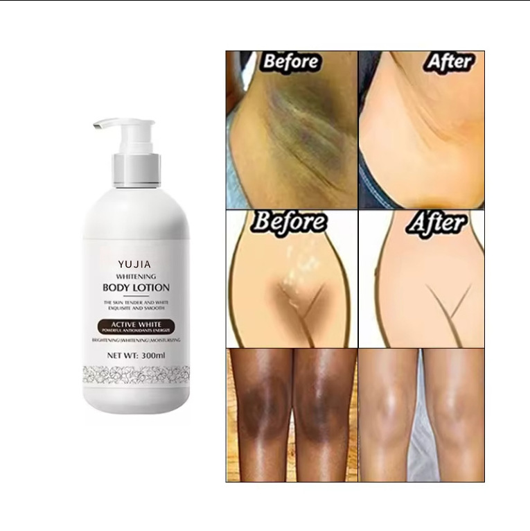 korean whitening  retinol AHA vitamin c moisturizer lightening women skin whitening body lotion armpit underarm whitening cream