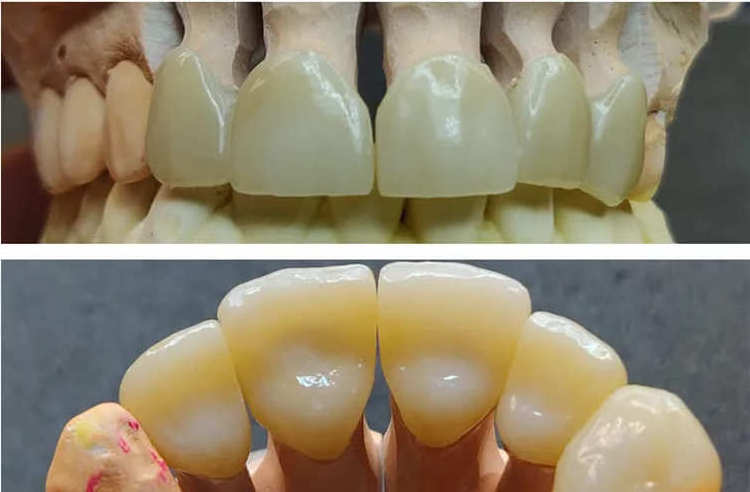 Yucera denture ceramic block multilayer zirconia disc dental CAD CAM disc dental product for dental lab for open system