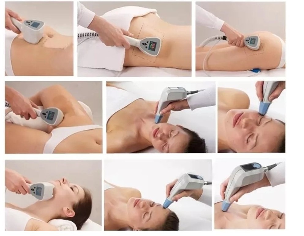 Slimming beauty machine Ultra is the first non-invasive device to deliver simultaneously Ultrasound and Radio Frequency.