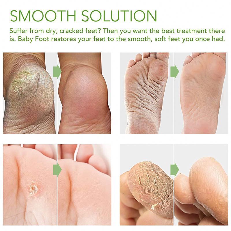 Baby Repair Rough Heels Get Silky Soft Moisturizing exfoliating peeling feet peel mask foot spa