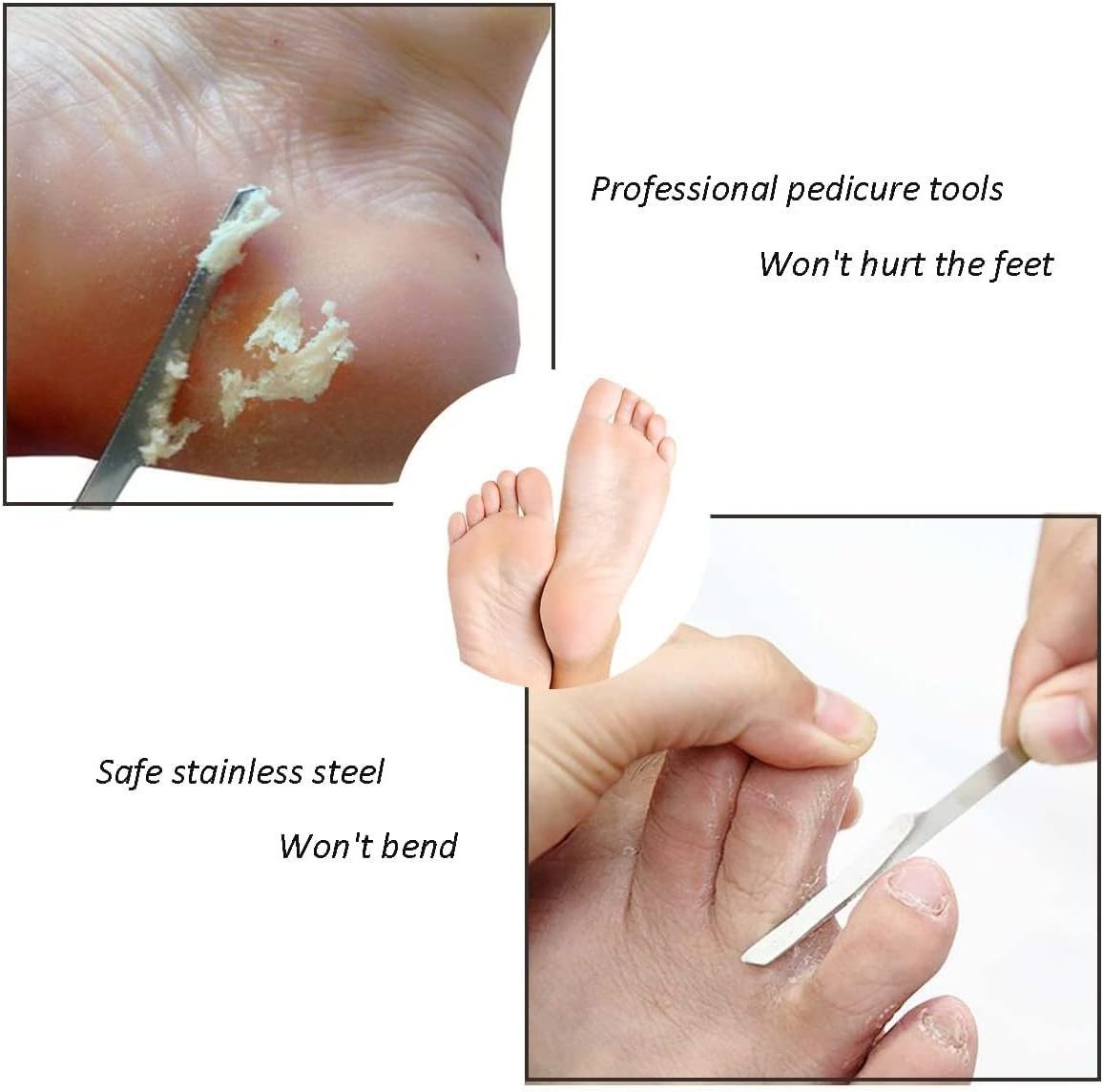 Stainless Foot Corn Remover Hand Foot Care Callus Dead Skin Remover Scraper Foot Remove Dead Skin Callus Knife Scraping Pedicure