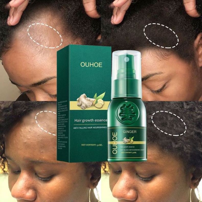 OUHOE High Quality Private Label  Organic Ginger Hair Growth Spray Serum Anti Hair Loss Oil Smoothing Repairing Hair Treatment