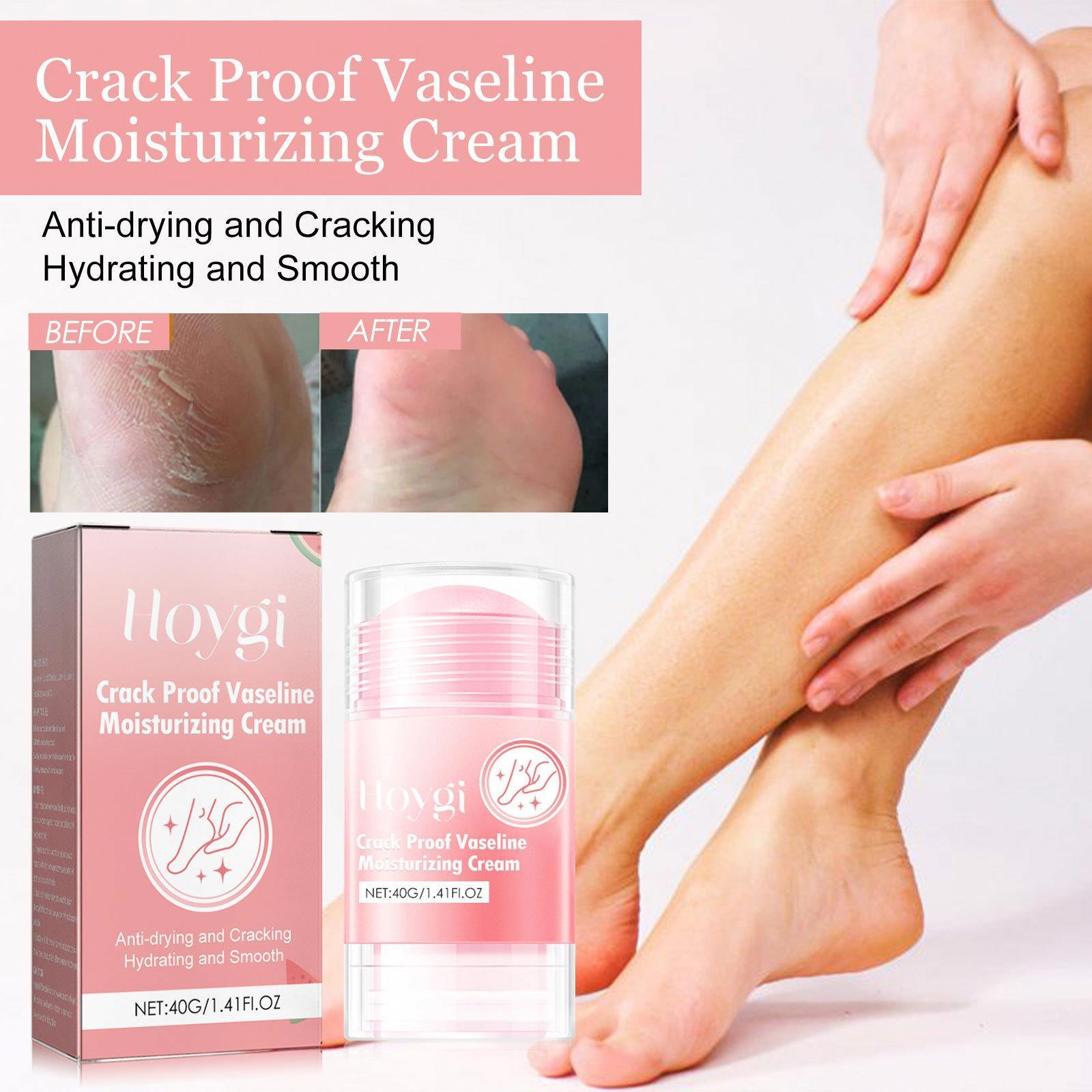 HOYGI Wholesale Private Label New Hot  Moisturizing Hand Cream Dry Cracked Feet Cracked Heel Repair Balm Foot Balm Heel Stick