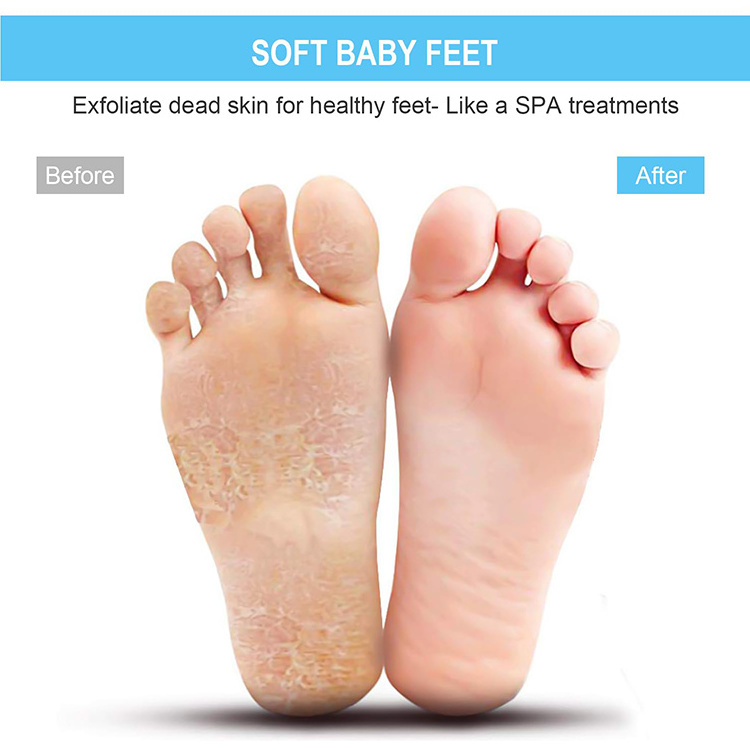 Wholesale Non-Slip Shower Foot Massager Deep Foot Cleaning And Exfoliating Silicone Brush Soothes Feet Foot Scrubber