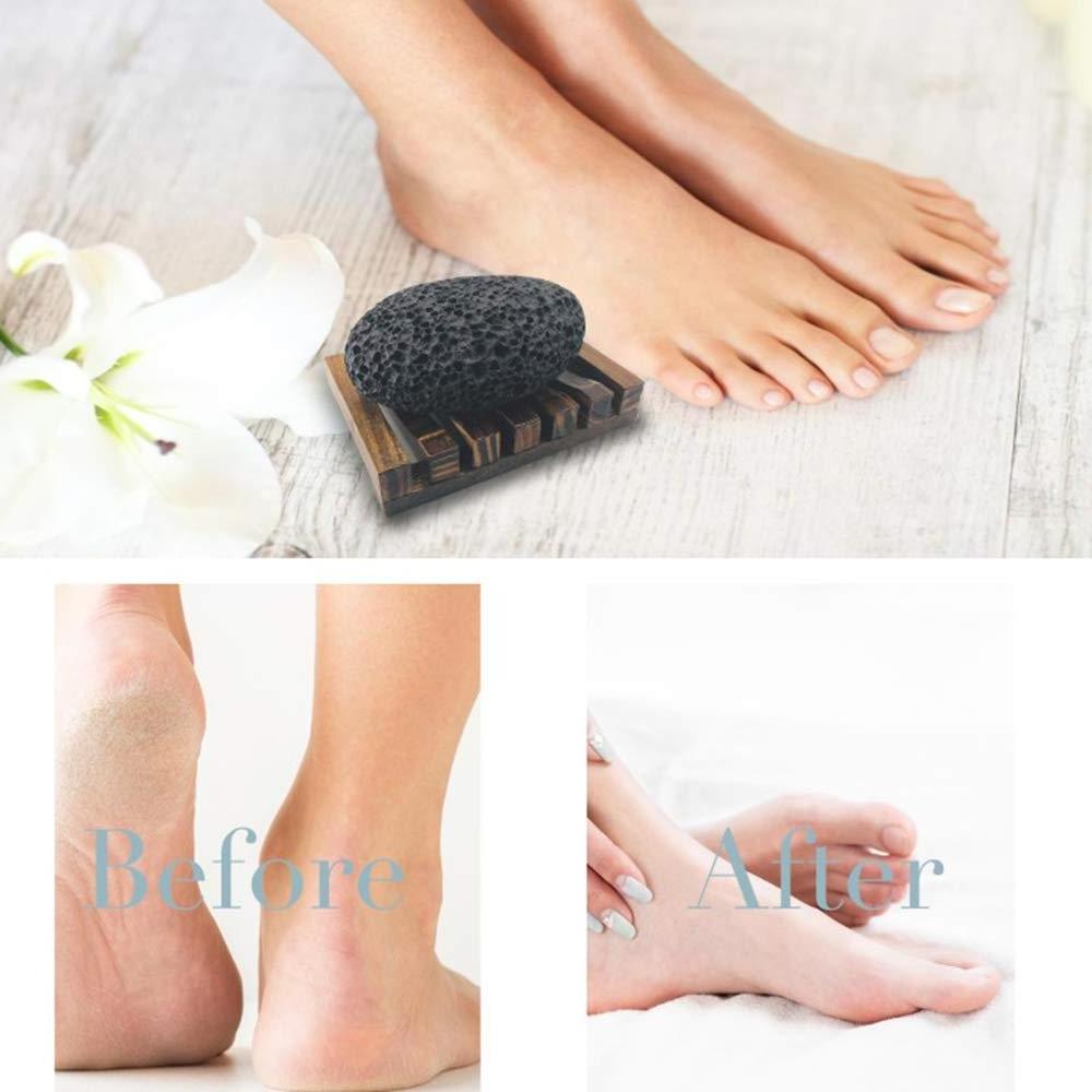 Lava Pumice Stone for Feet Scrubber Stone for Feet and Hands with Organic Wooden Bath Tray Pedicure Tools Natural Foot Scrub