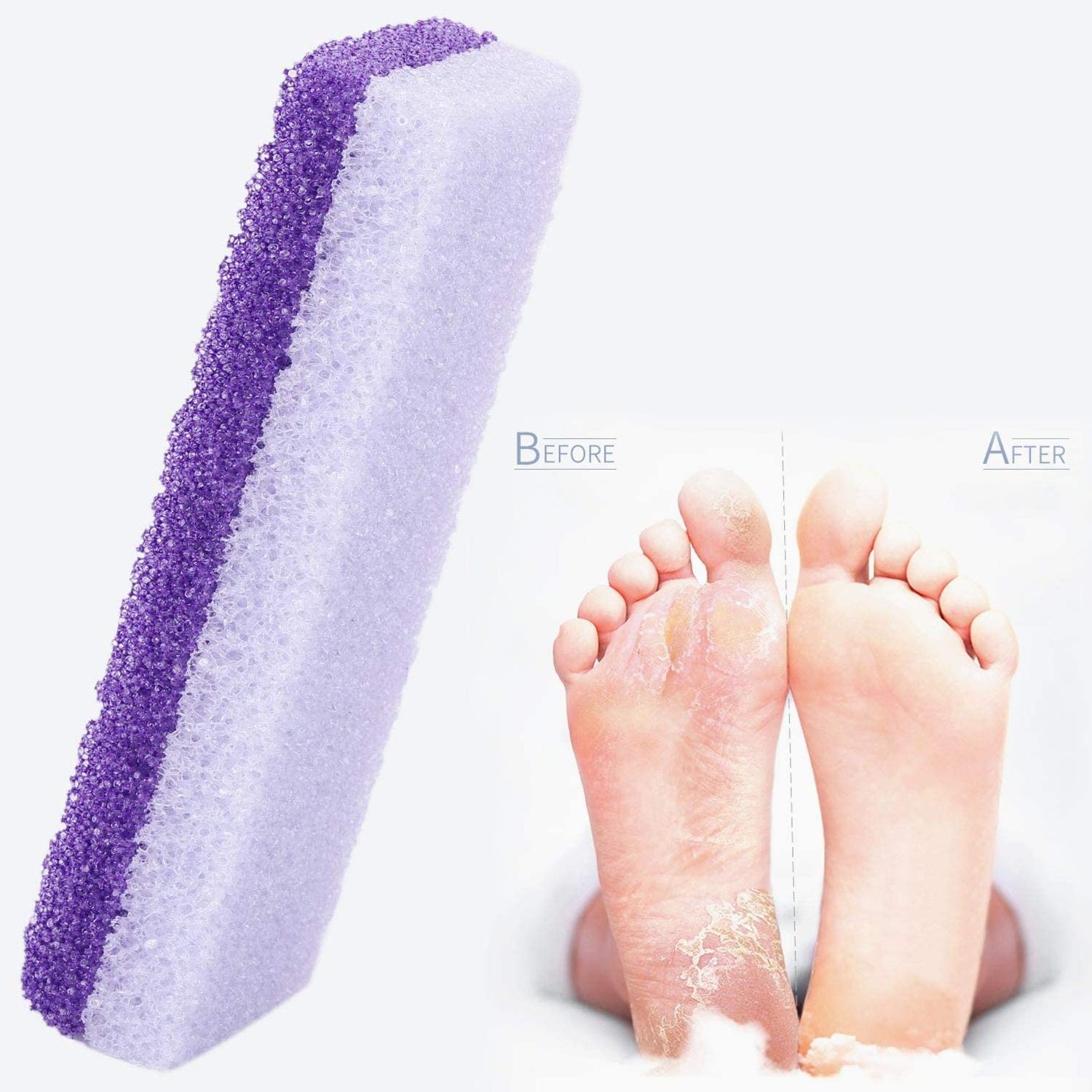 Foot Pumice Stone 2 in 1 Double Sided Foot Scrubbers Pedicure Callus Remover Purple Pumice Sponge Heel Buffer for Feet Dead Skin