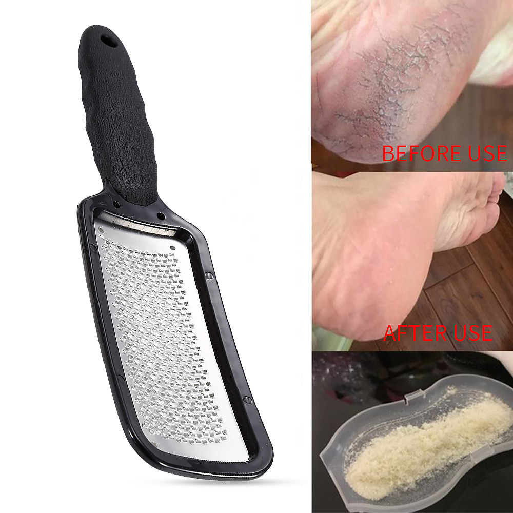 Callus Remover Corn Trimmer Colossal Pedicure Scrubber Tool Foot Rasp File Device Foot Sander