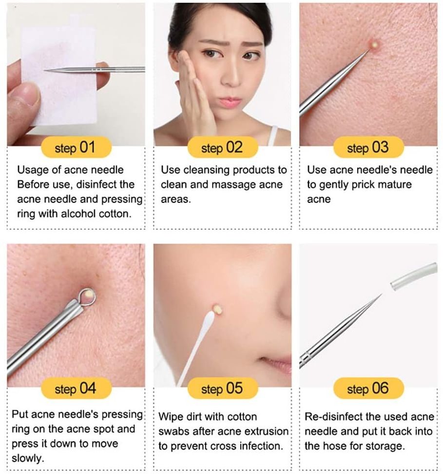 Blackhead Remover Pimple Comedone Extractor Tool Acne Removal Kit - Treatment for Blemish, Whitehead Popping, Zit Removing