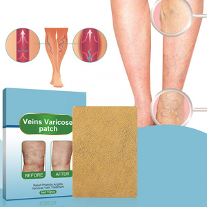 chinese herbal patches for varicose veins leg treatment relieve leg soreness and swelling and remove varicose blood vessels