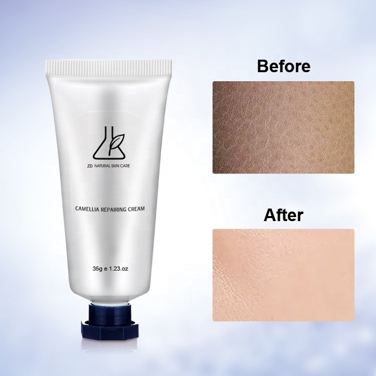 OEM ODM Skin White Chloasma Remover Facial Treatment Nicotinamide Whitening Bleaching Freckle Face Cream