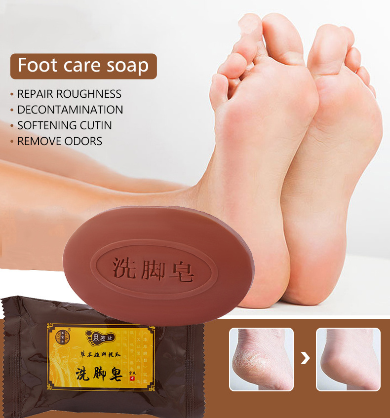 Hot Sale Foot Skin Care Beriberi Antipruritic Deodorant Perspiration Exfoliating Foot Care Herbal Soap