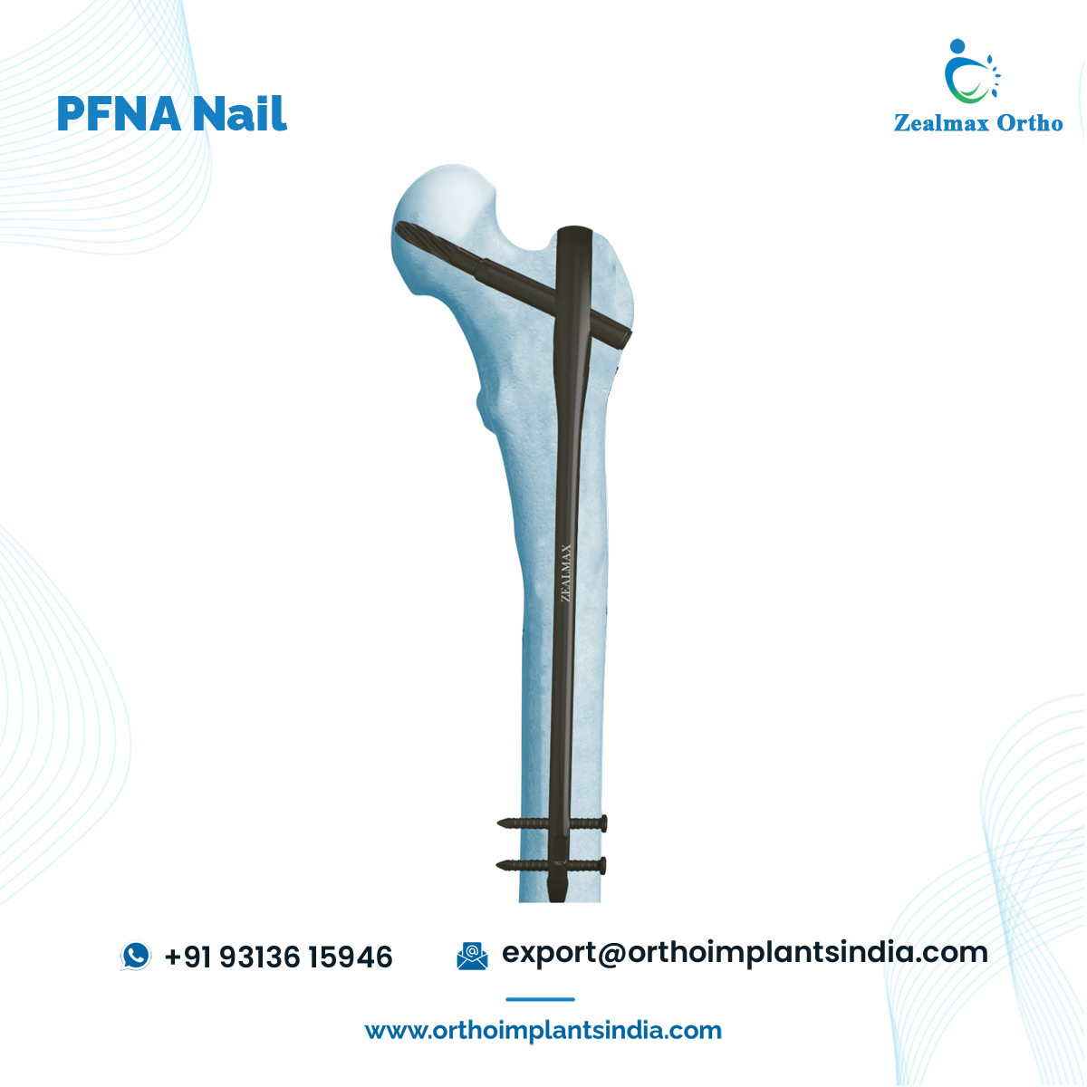 Zealmax Ortho Orthopedic Trauma Implants High Quality Pure Titanium Material PFNA Femoral Intramedullary Nail