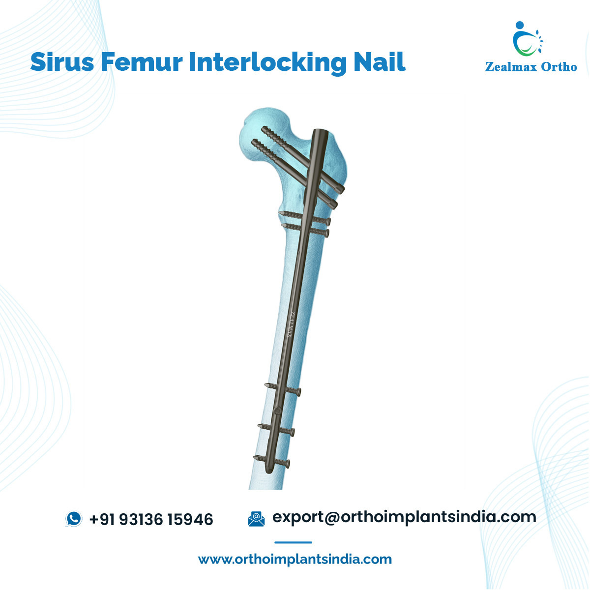 High Quality Wide Range Available Titanium Orthopedic Trauma Bone Implants Sirus Femur ILN Interlocking Intramedullary Nail