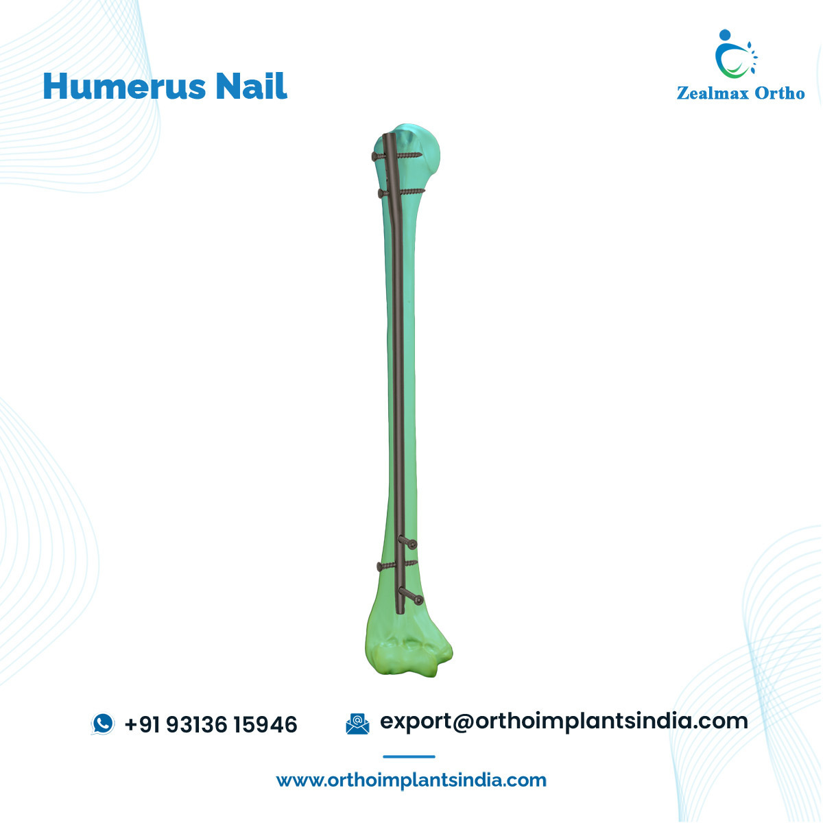 Zealmax Ortho Trauma Orthopedic Implants Manufacturer Humerus Bone Interlocking Intramedullary Nail