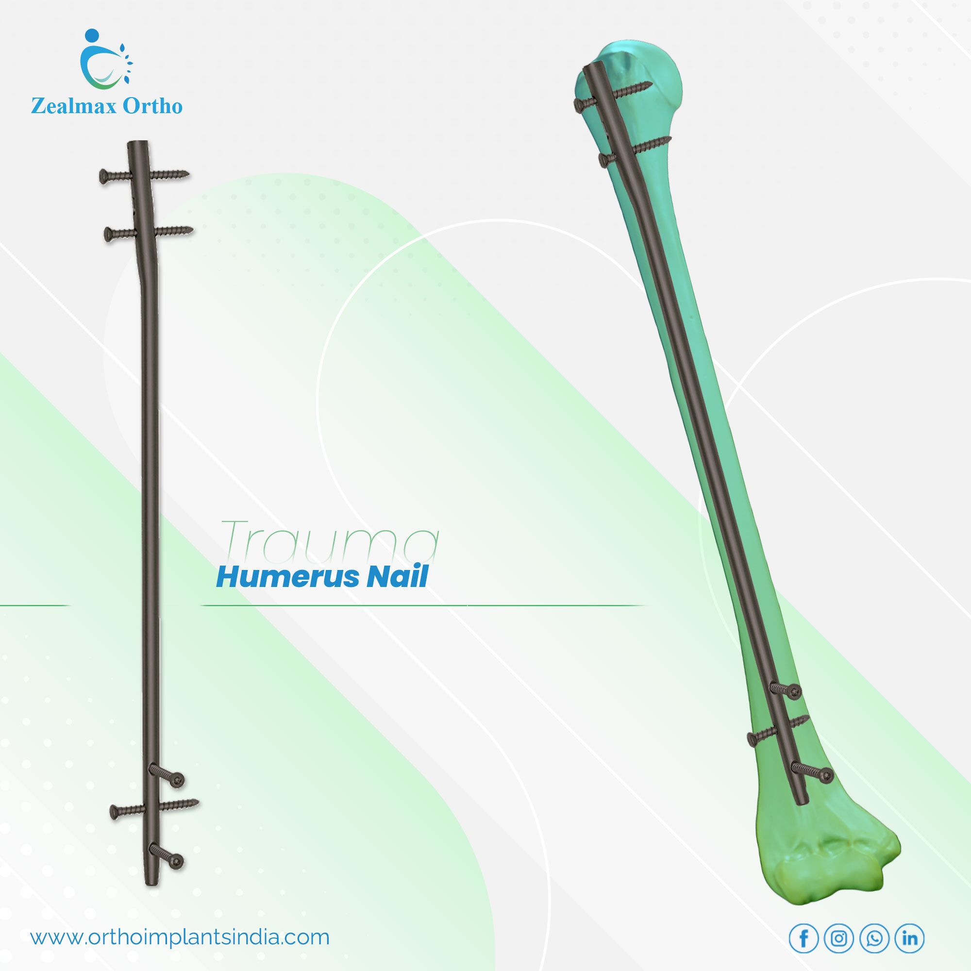 Zealmax Ortho Fine Quality Material Trauma Orthopedic Implants Humerus Bone Intramedullary Interlocking Nail