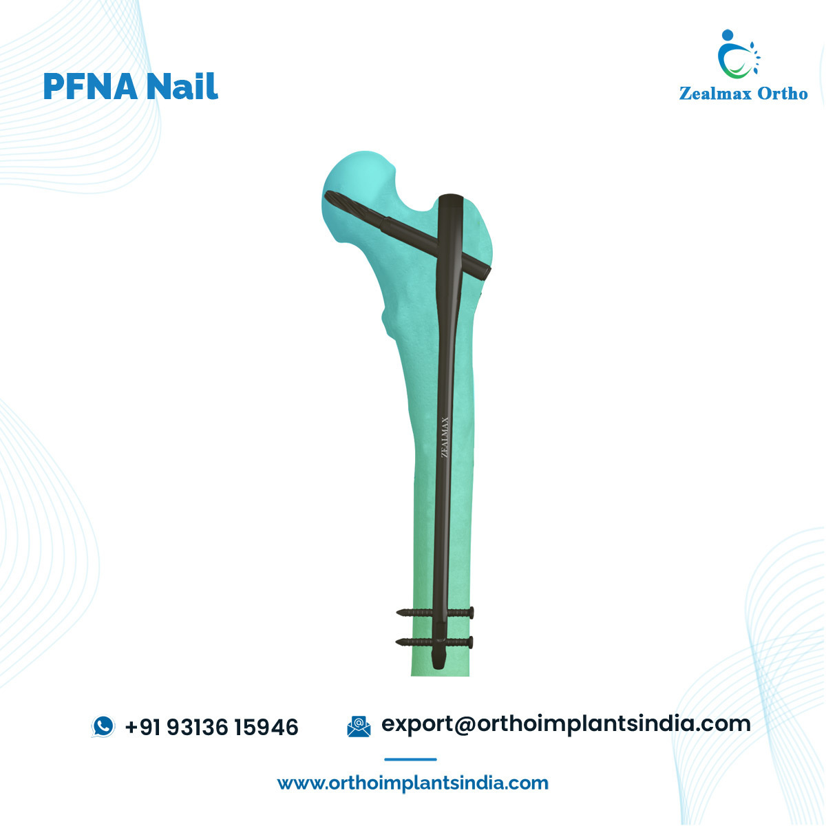 Zealmax Ortho Pure Titanium PFNA Femoral Intramedullary Interlocking Nail At Best Price