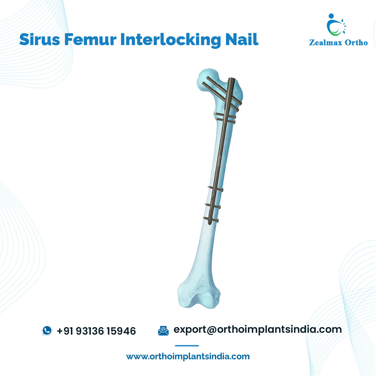 High Quality Wide Range Available Titanium Orthopedic Trauma Bone Implants Sirus Femur ILN Interlocking Intramedullary Nail