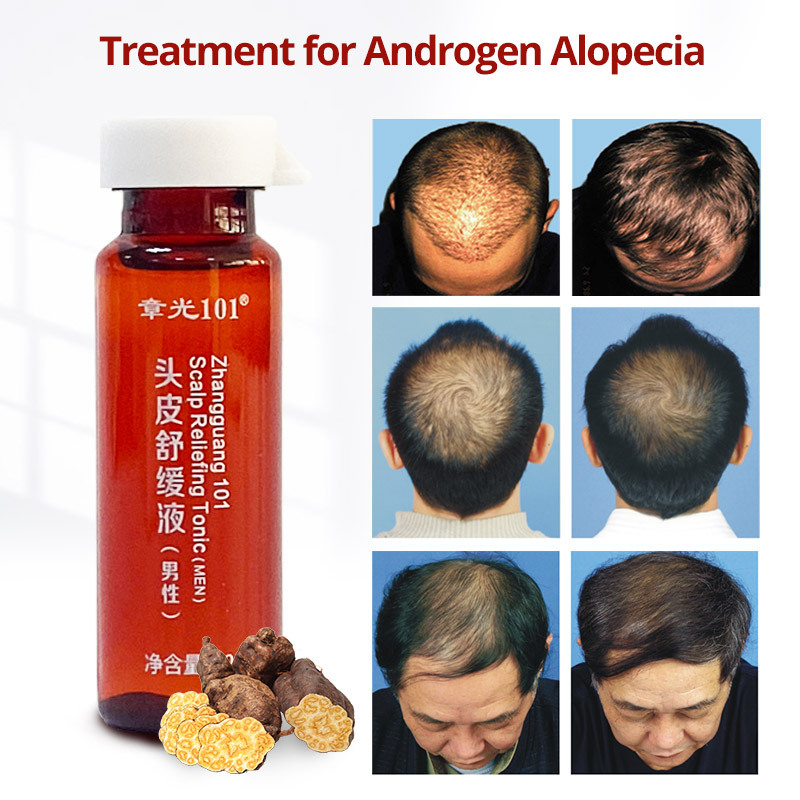 OEM Ampoule Nourishing Scalp Natural Hair Care Growth Serum for Men