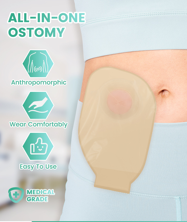 Two piece Drainable Medical Adhesives  Urostomy Urine Ostomy Bag urostomy bag supplier