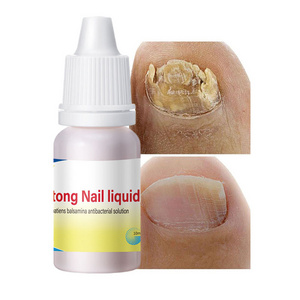 Onychomycosis Care Antifungal from Remover Gel Oil Liquid Adults Nail Fungus Treatment OEM ODM Private Label Hand Skin