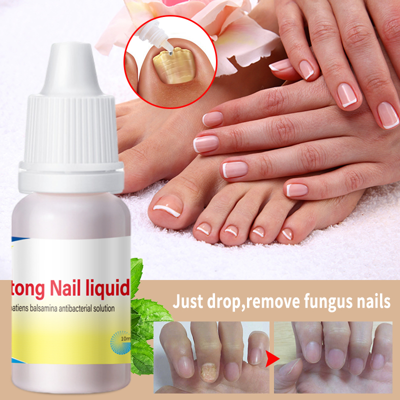 Onychomycosis Care Antifungal from Remover Gel Oil Liquid Adults Nail Fungus Treatment OEM ODM Private Label Hand Skin