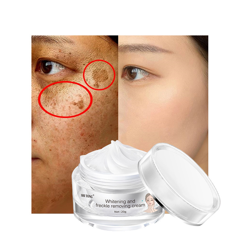 Black spot remover face cream best face whitening cream for black skin top ranking products 2022 carotone cream spot corrector