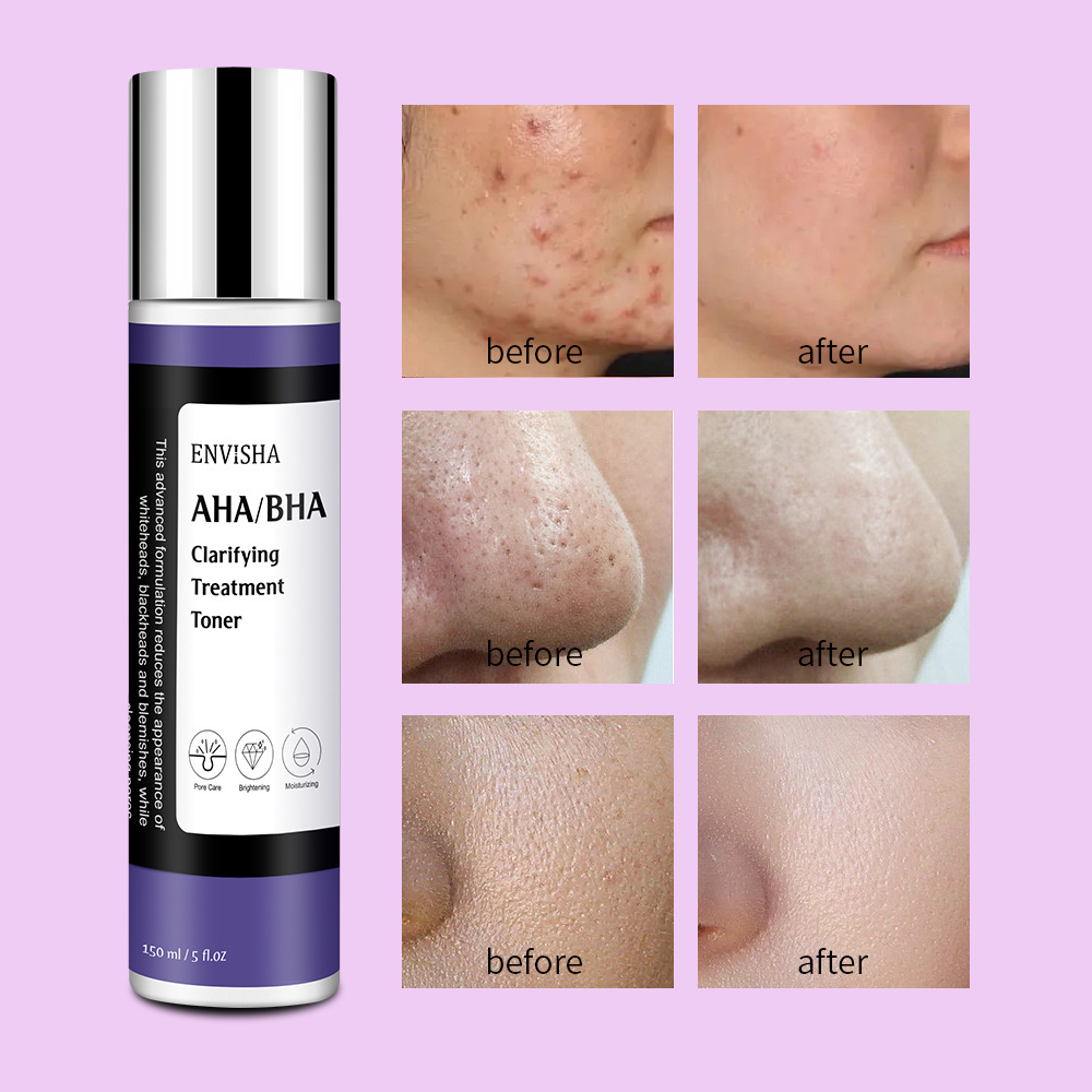 Personal Label Facial Exfoliating AHA BHA Clarifying Treatment Exfoliator Toner For Whiteheads Pores And Uneven Skin