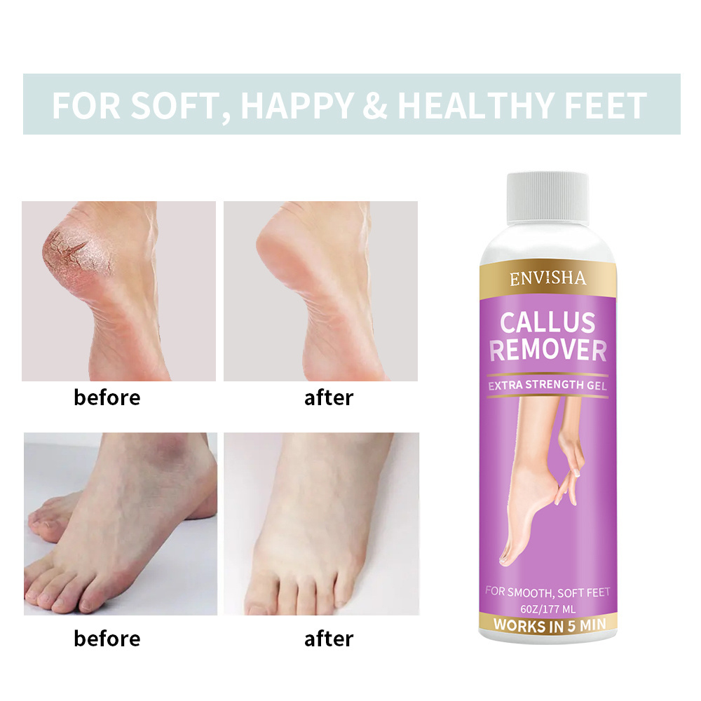 Feet Dead Skin Remove Exfoliating Foot Callus Remover Gel For Dry Cracked Feet