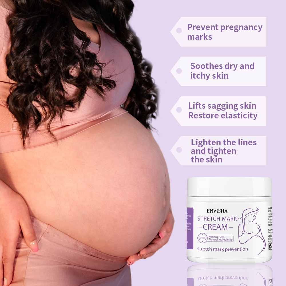 Private Label Best Natural Stretch Mark Cream Pregnancy Scar Removal Maternity Treatment Stretch Marks Scar Removal Cream