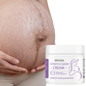 Private Label Best Natural Stretch Mark Cream Pregnancy Scar Removal Maternity Treatment Stretch Marks Scar Removal Cream