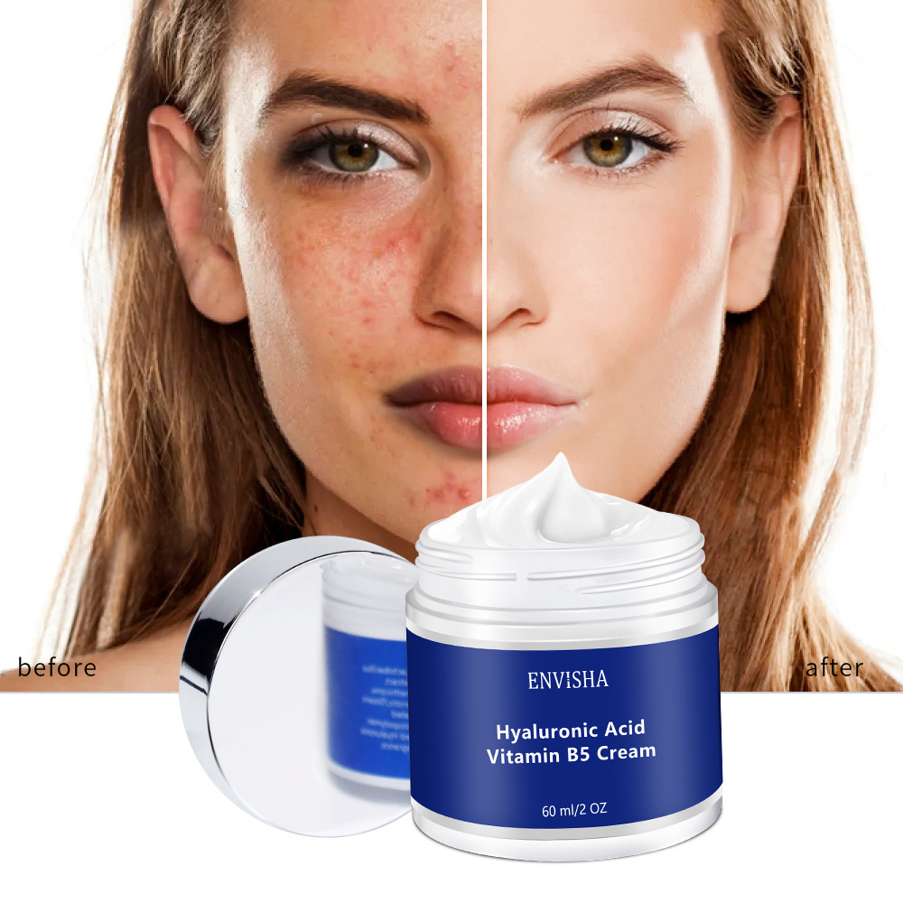 OEM ODM Organic Hyaluronic Acid Anti Aging Moisturizer Vitamin B5 Face Day and Night Anti Wrinkle Cream