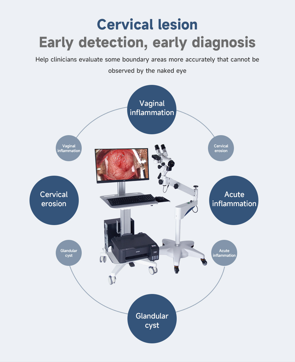 Portable Digital  Camera With Video For Gynecology Video colposcope Camera for Vagina