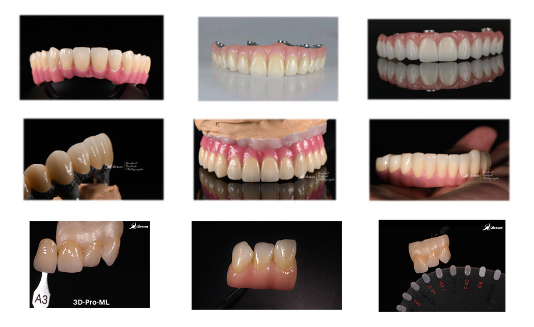 High Strength CADCAM milling 3D-Pro Zirconia pucks cad cam for dental lab Ceramic Zirconia Block Zirconia Products