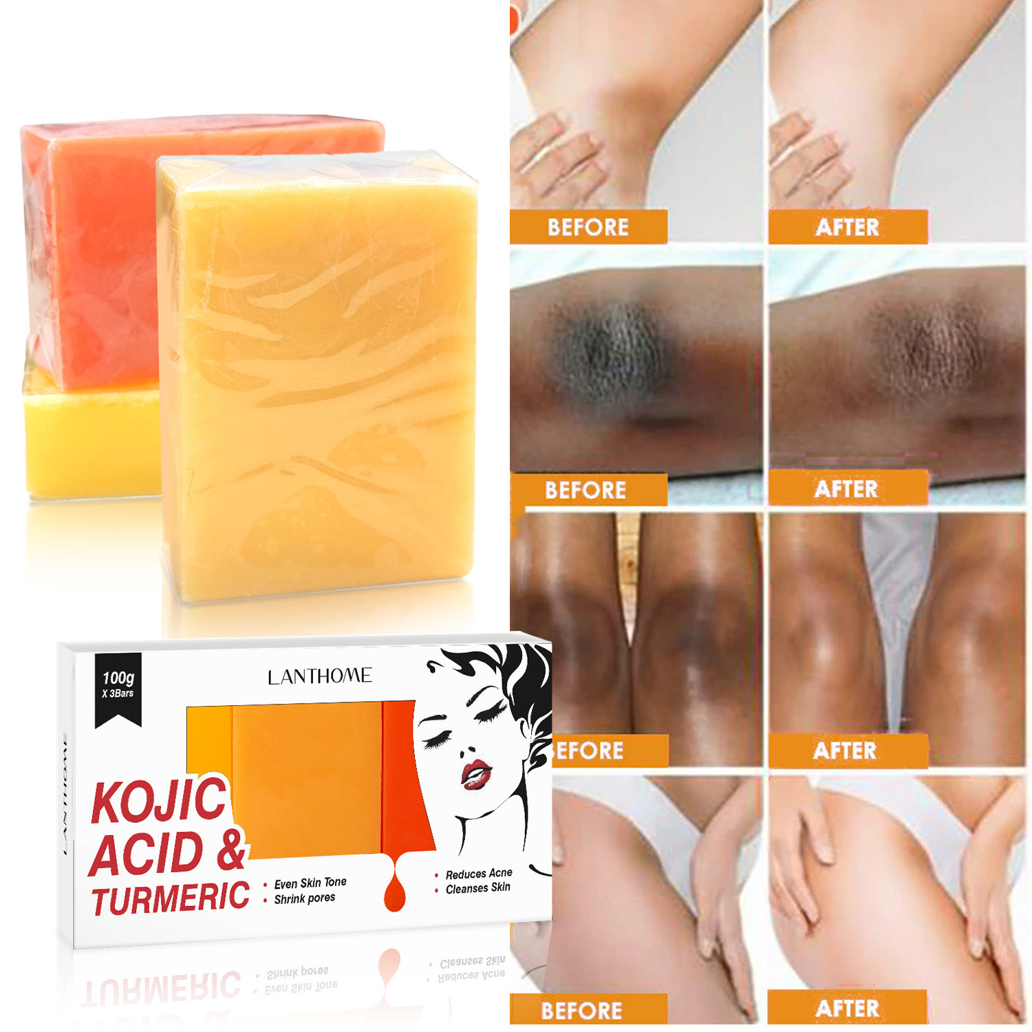 LANTHOME 3 PCS Wholesale Brands Kojie San Handmade Original Whitening Skin Care Raw Material Kojic Acid soap