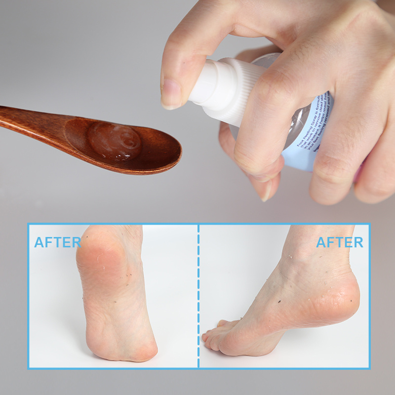 Nourishing Feet  Effective Skin Care Foot Masking Moisturizing Softening Instant Peeling Spray