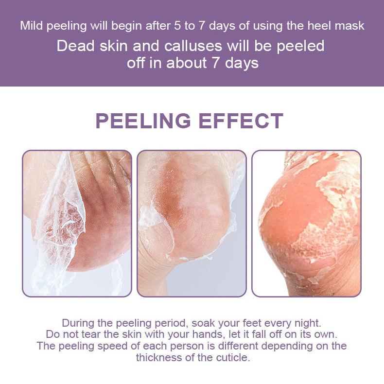 Private Label Repair Rough Foot And Dry Rough Heel Heels Peel Exfoliating Foot Peel Hand Peeling Mask