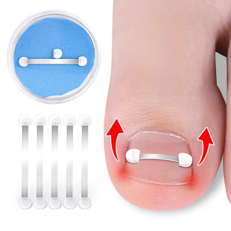 Stainless Steel Toenail Correction Pedicure Tool for Nail Recover Foot Care Ingrown Toenail Correction Treatment Kit