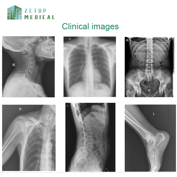 200mA Mobile DR X-ray machine with image post-processing software, flat panel detector, etc