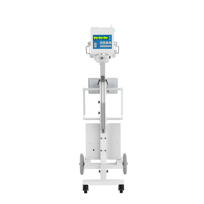 High Frequency Radiography 8KW 160MA X-ray System Medical Diagnostic Mobile X Ray Machine Price